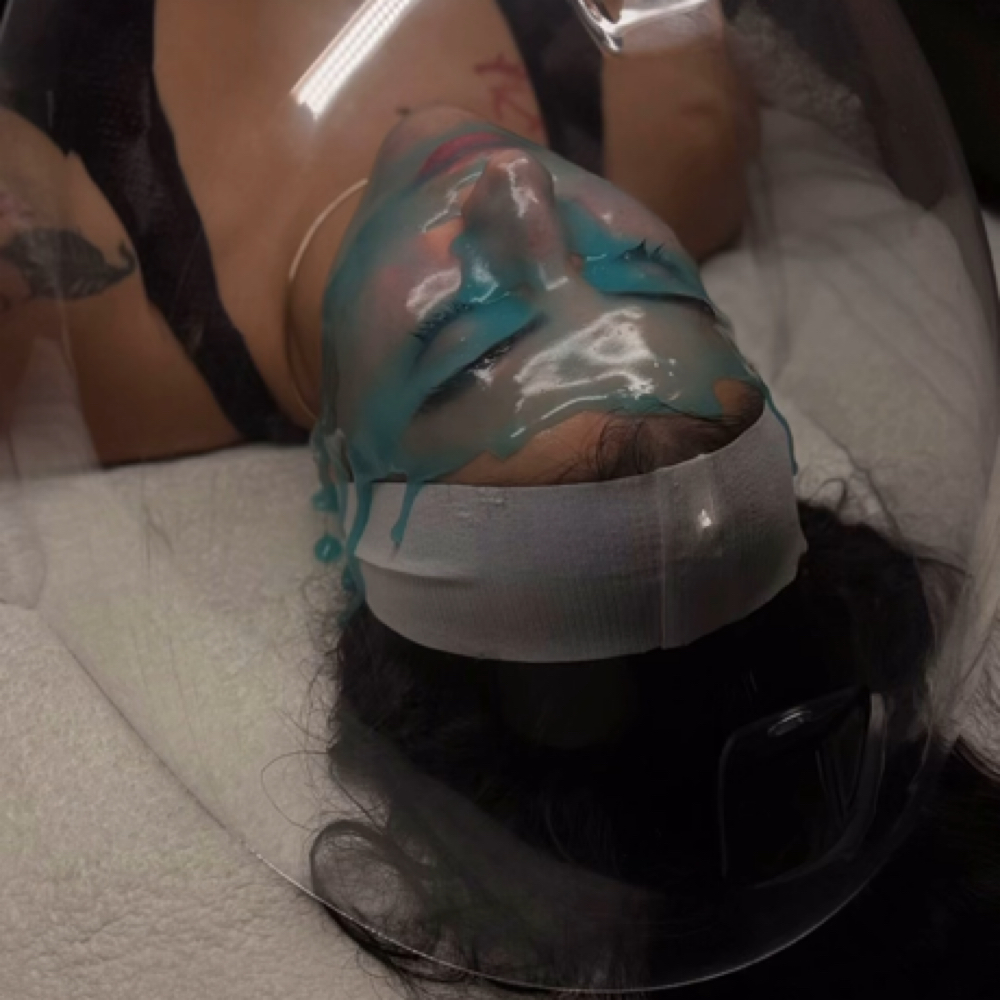 oxygen dome + hydrojelly at Skincare Hacker in Sunny Isles Beach, FL