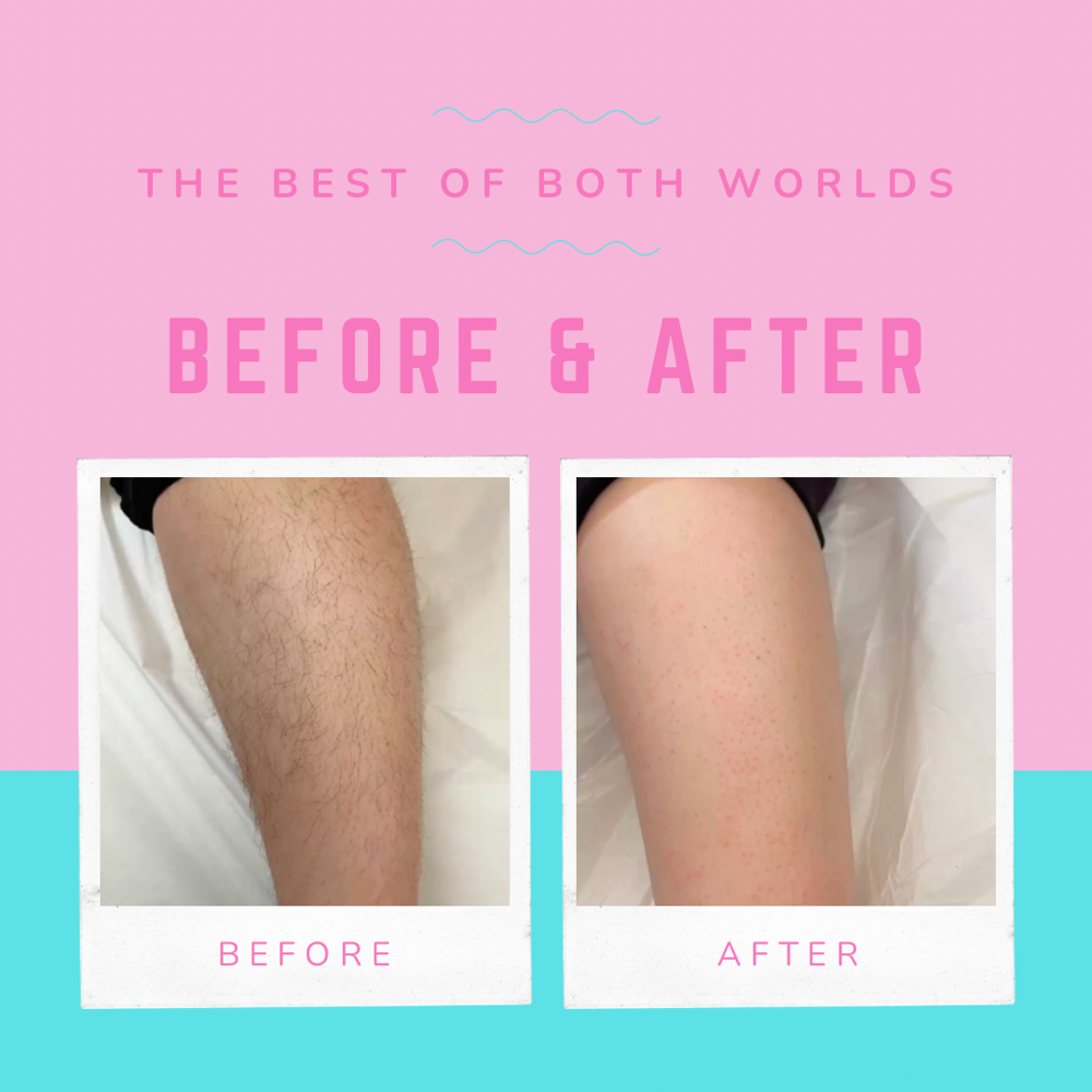 Arm Waxing