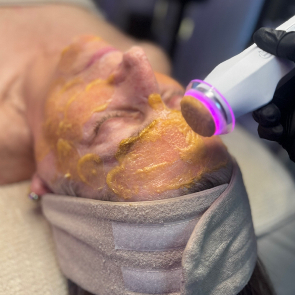 PureO2 Glow Facial at Glow with Lindsay Esthetics in Rodeo, CA