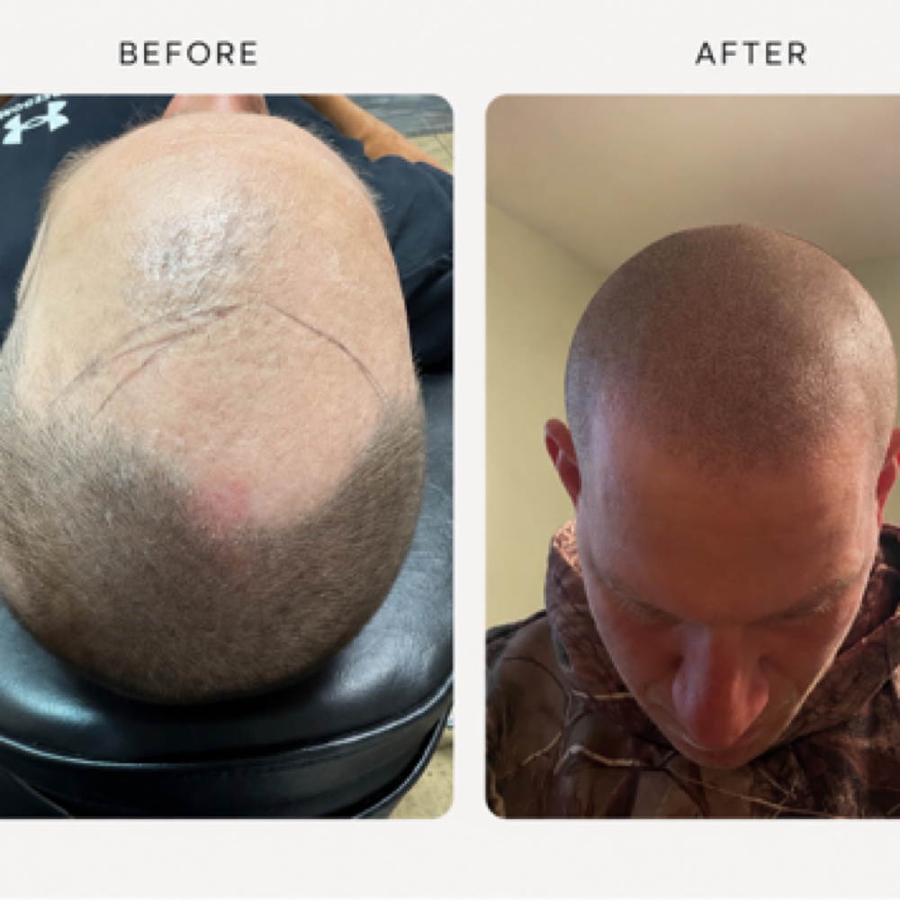Scalp Pigmentation at Northern Beauty in Gaylord, MI