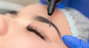 Jet Plasma Treatment