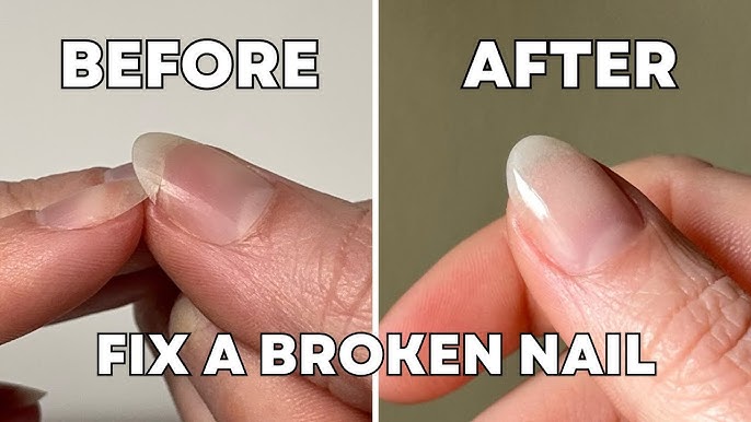 Nail Fix