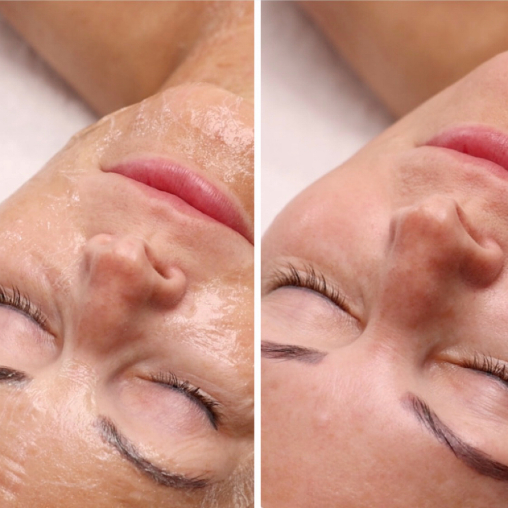 Radiant Peptide Lift Facial at Radiant Ritual Skin-Wax-Wellness LLC in Temecula, CA