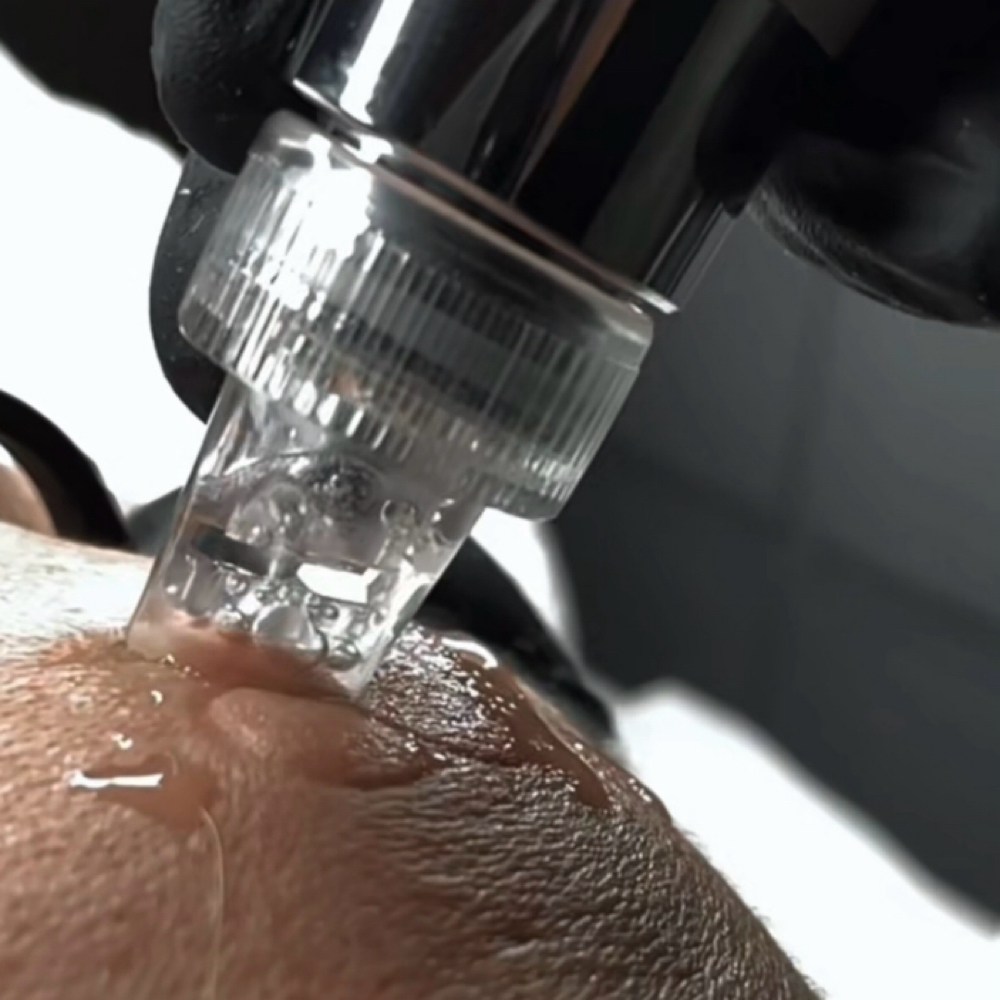 Hydro-Facial at Graceful Effects Day Spa in Brandon, MS