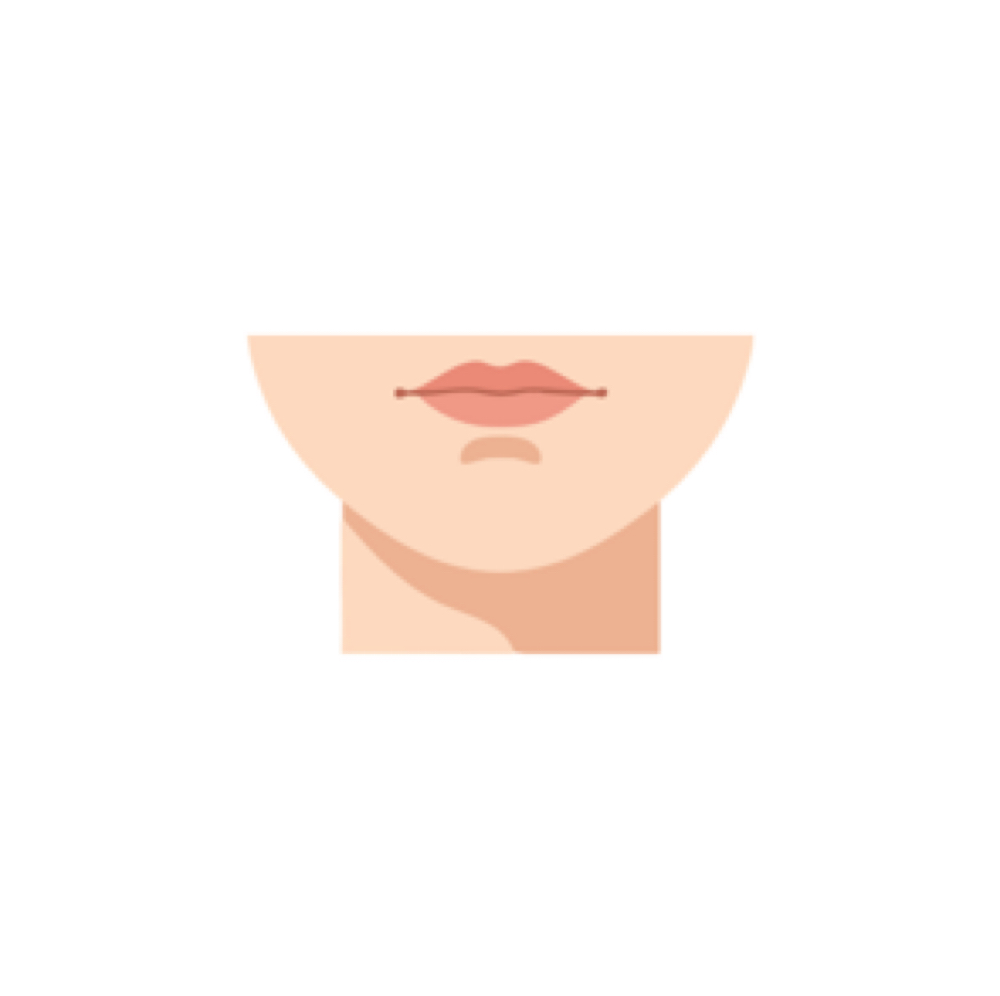 Chin Wax at Esthetics by Ellie in Farmersville, TX
