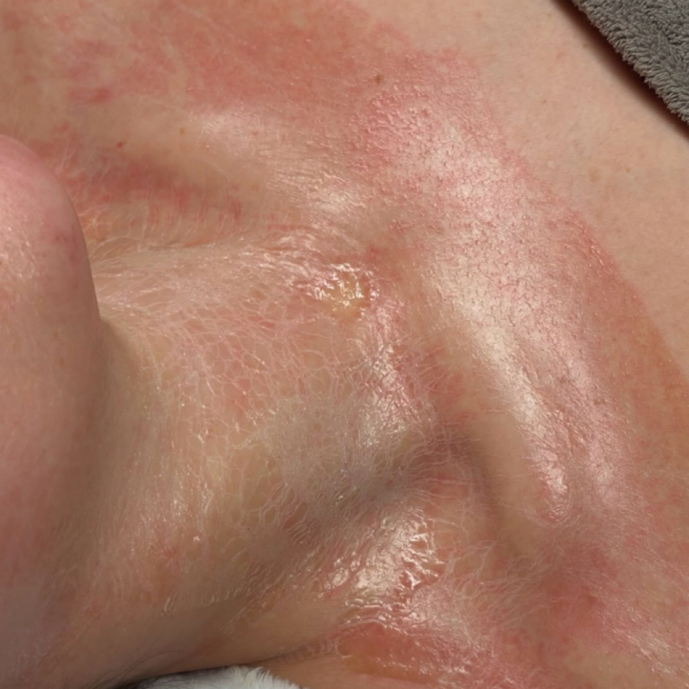 The Rewind Ritual (Peptide) Facial at Fairy Glow Studio in Toledo, OH