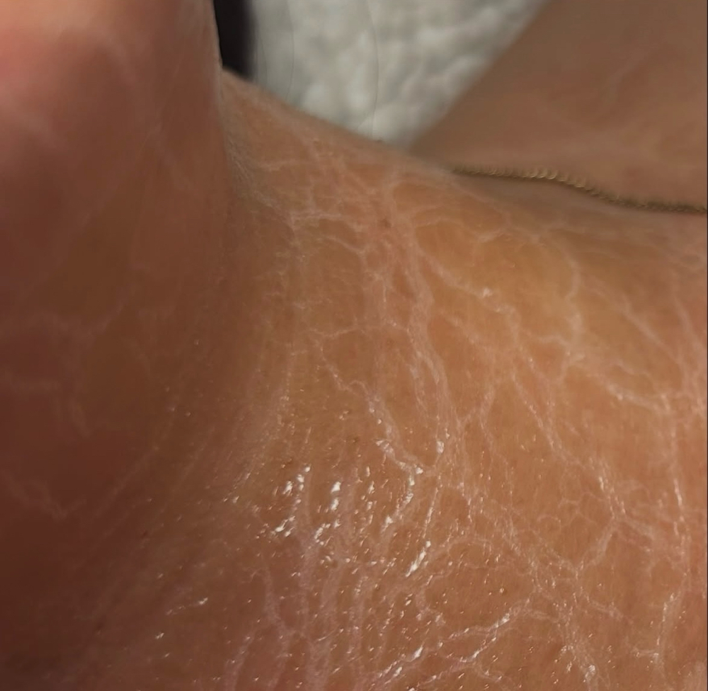The Rewind Ritual Facial
