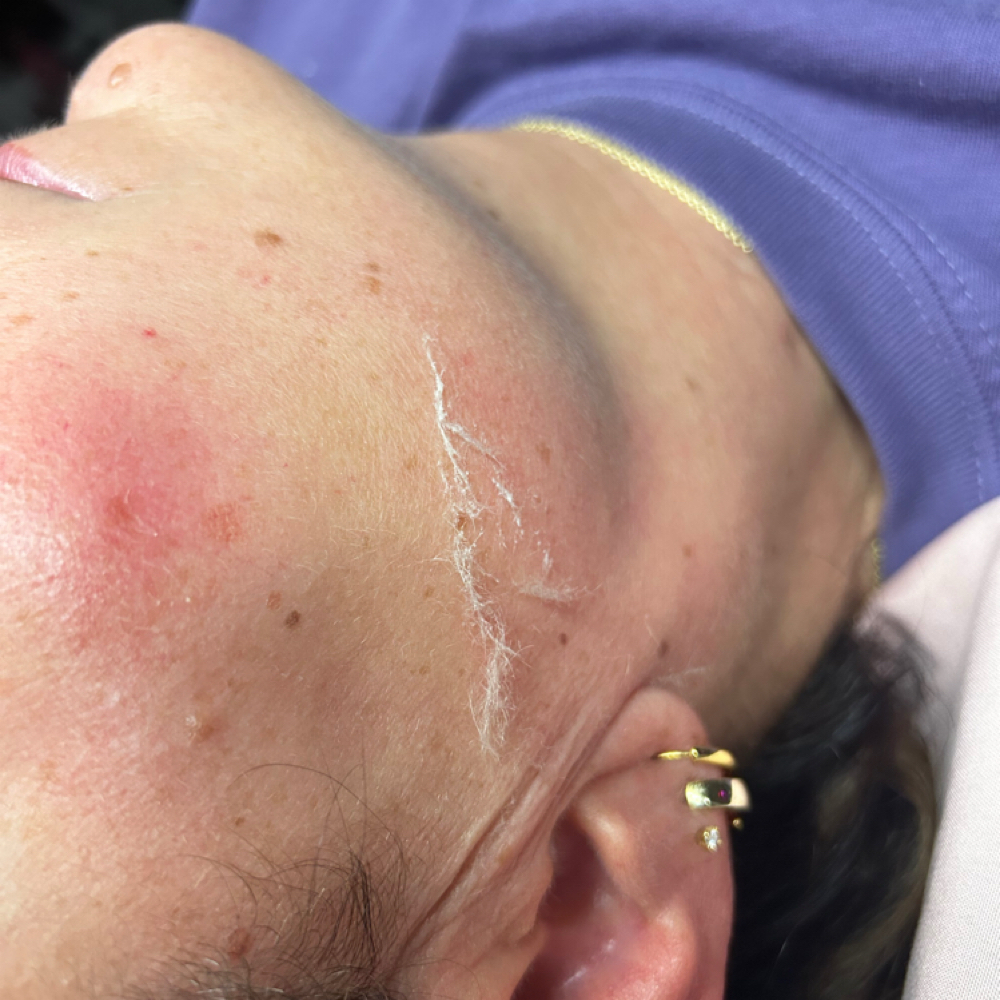 Derma-Plane Facial at EstheticsByTaegan in Searcy, AR