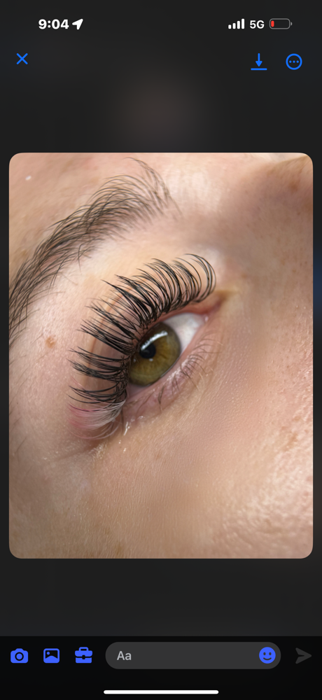 Classic Fill at KES Esthetics in Fairmont, WV