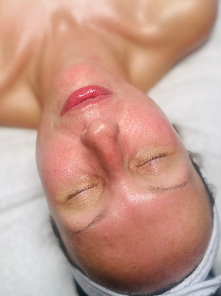 Vtox Anti Aging Facial