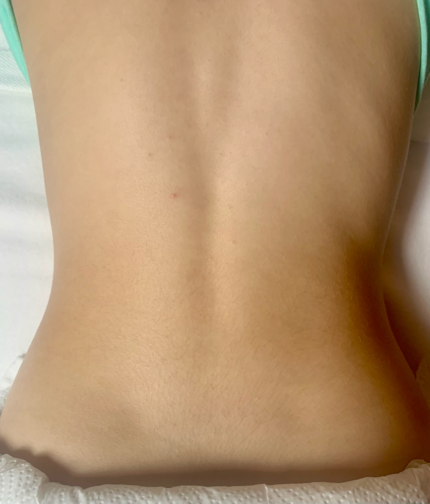 Full Back