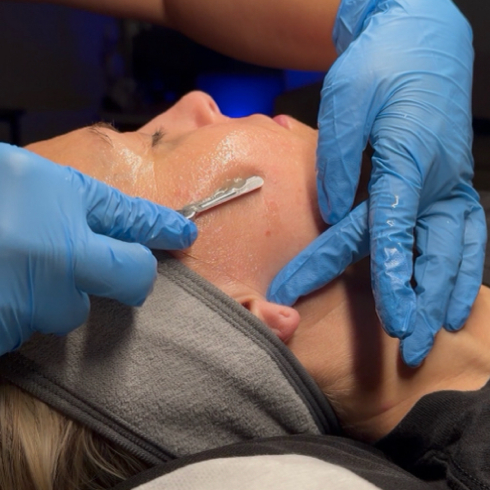 Dermaplaning Facial at Aesthetically You in Minneola, FL