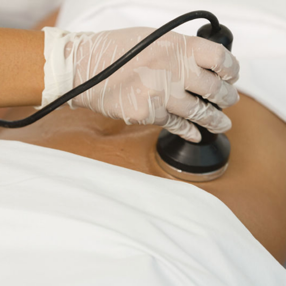 Lipocavitacion at RossyEstetic in Metaire, LA
