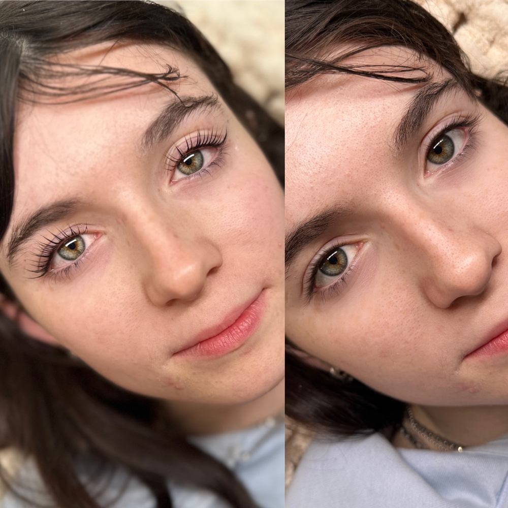 Eyelash Lift