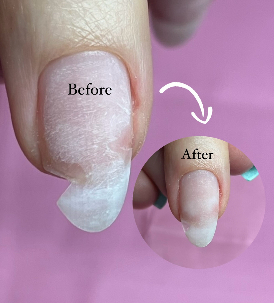 Nail Repair