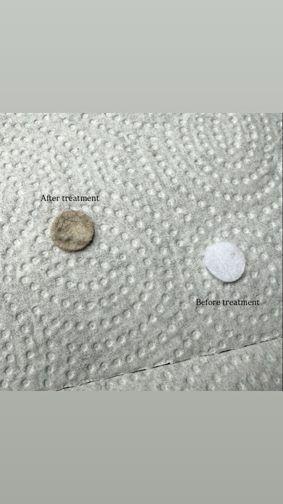 Microdermabrasion Facial at J Esthetics in Homewood, IL