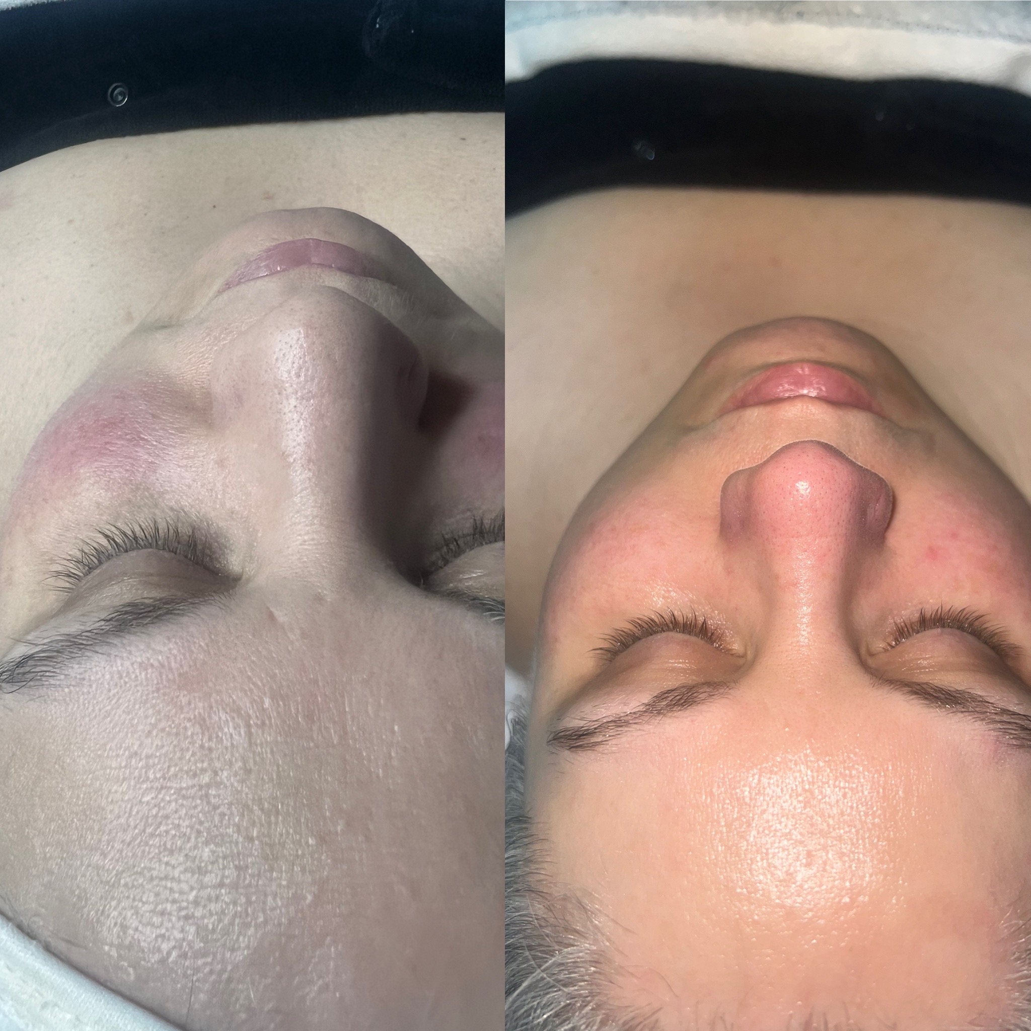 Calming Facial For Sensitive Skin