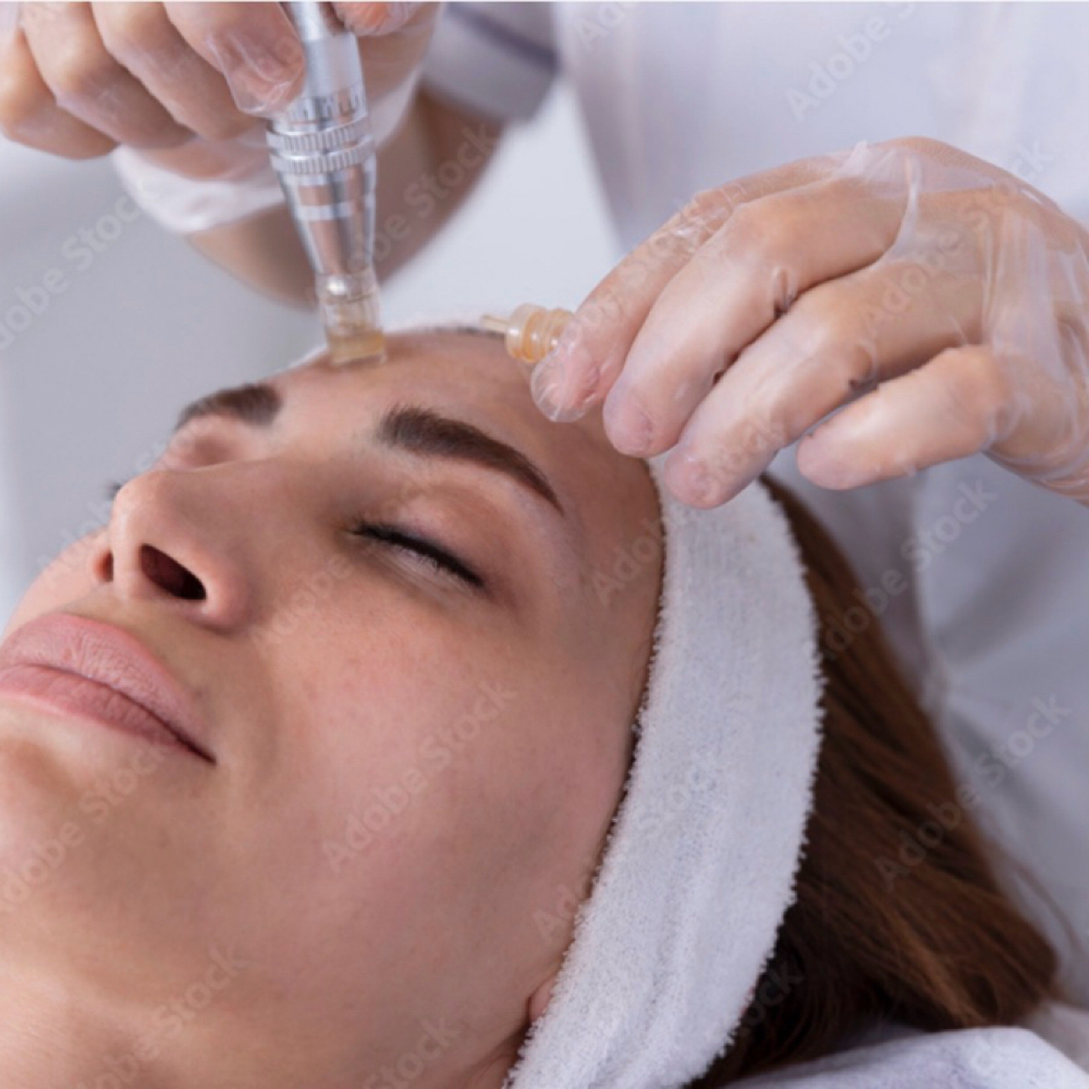 Nano Infusion at Pattyb Wellness in Bellmore, NY