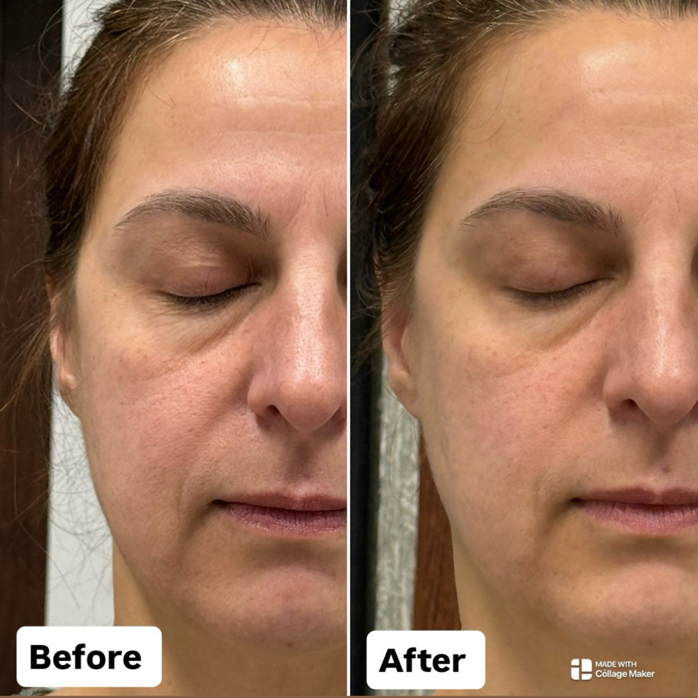 Facial & Scalp Care Ritual at Spa and Sculpting by Roza in Charlotte NC, NC