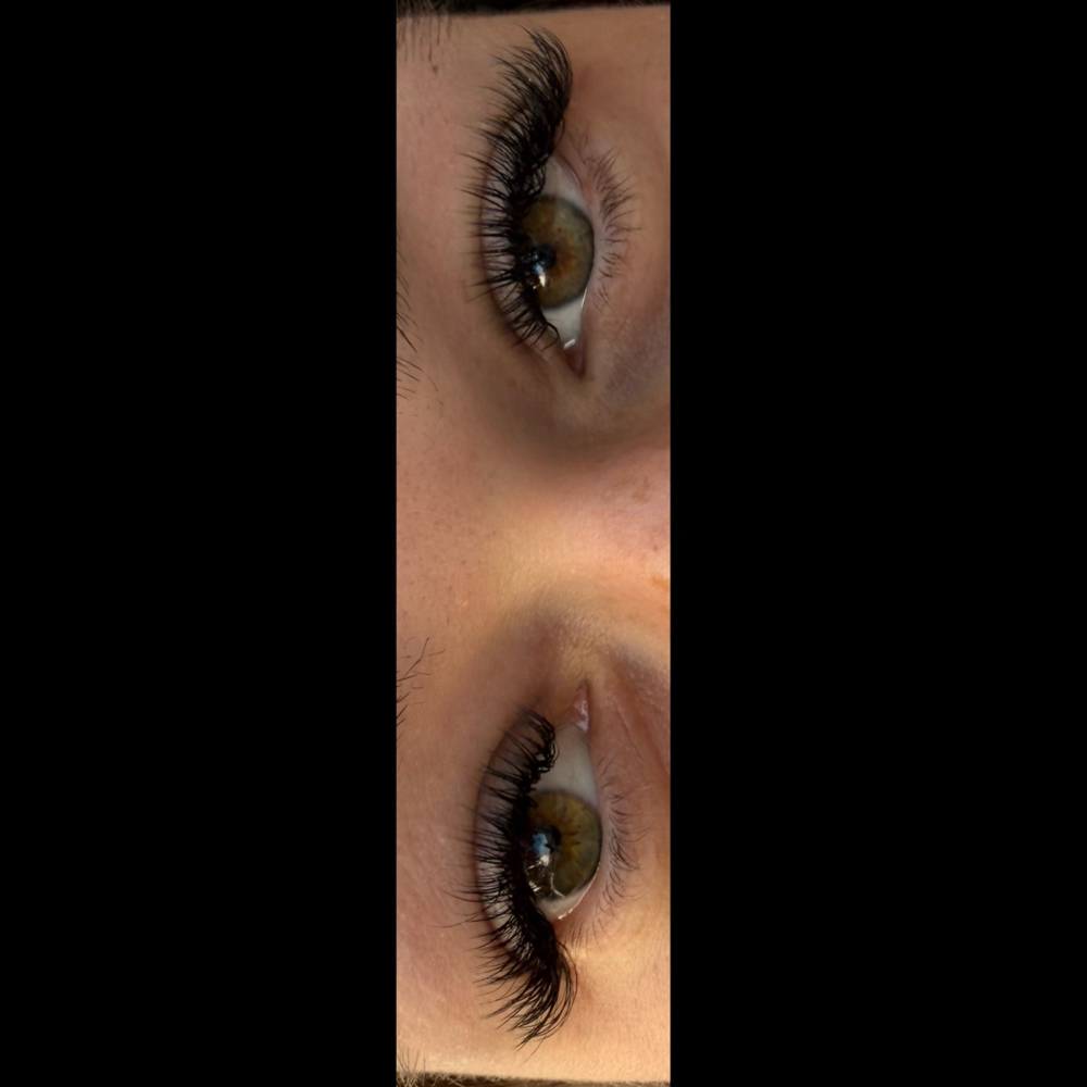 Fairy Fill: 3 Week (15-21 Days) at Beauty Craze in Indianapolis, IN