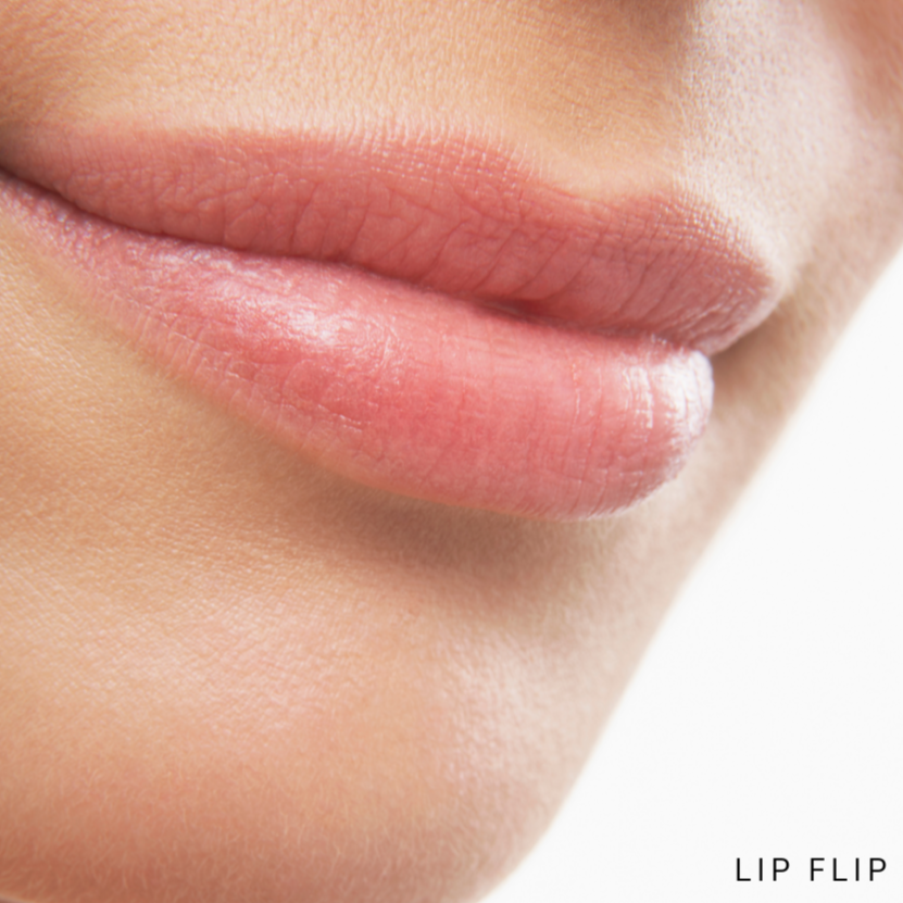 Botox - Lip Flip