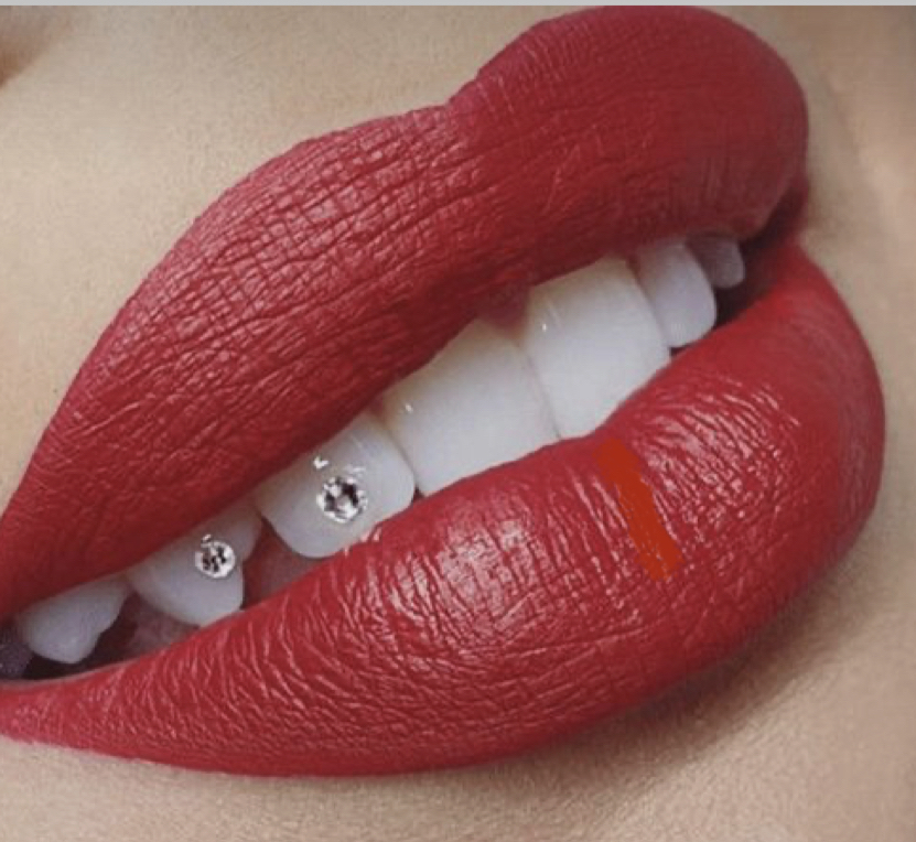 Tooth Gems
