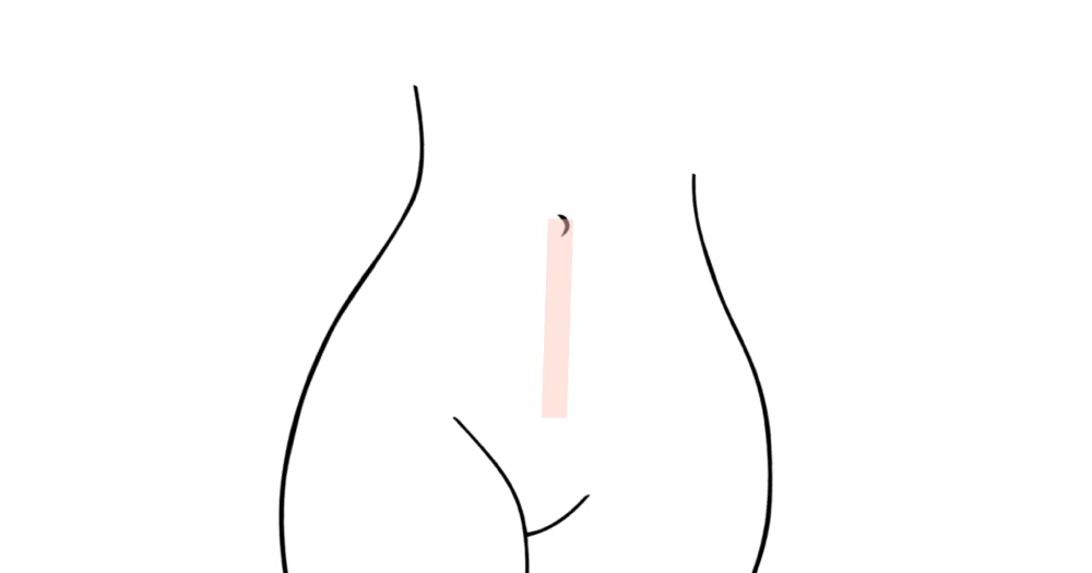 Stomach Strip