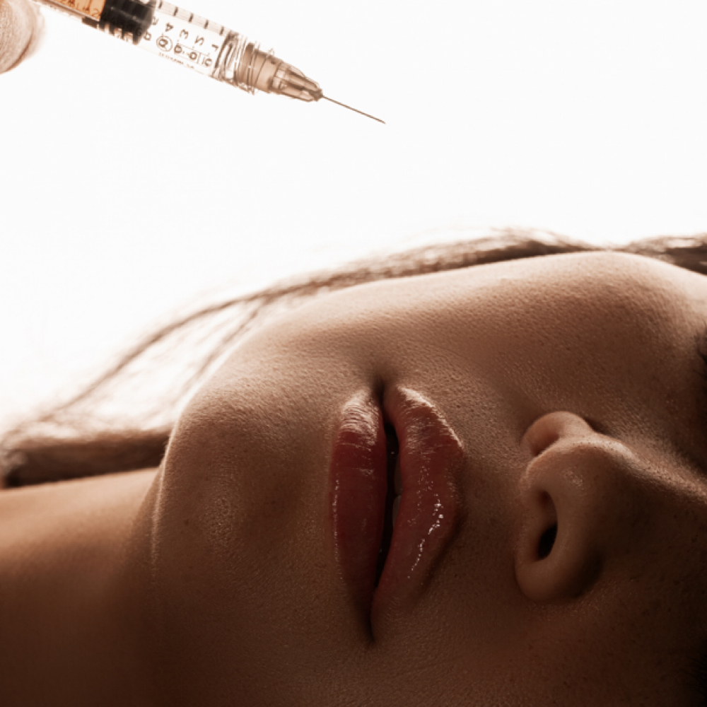 Mini Lip Filler at Fina Aesthetics in Houston, TX