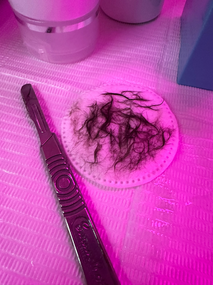 Dermaplane