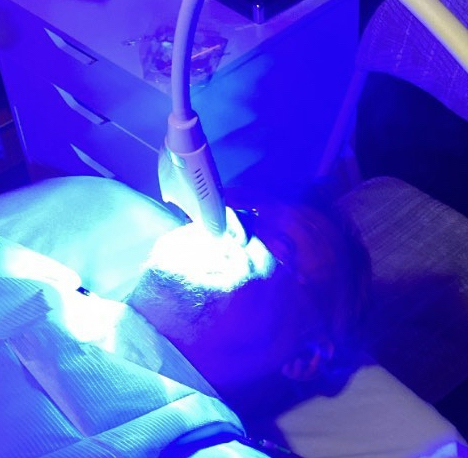 Teeth Whitening