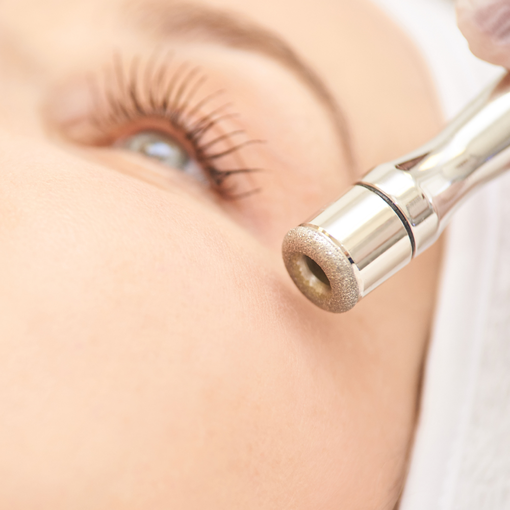 Microdermabrasion Facial Ritual