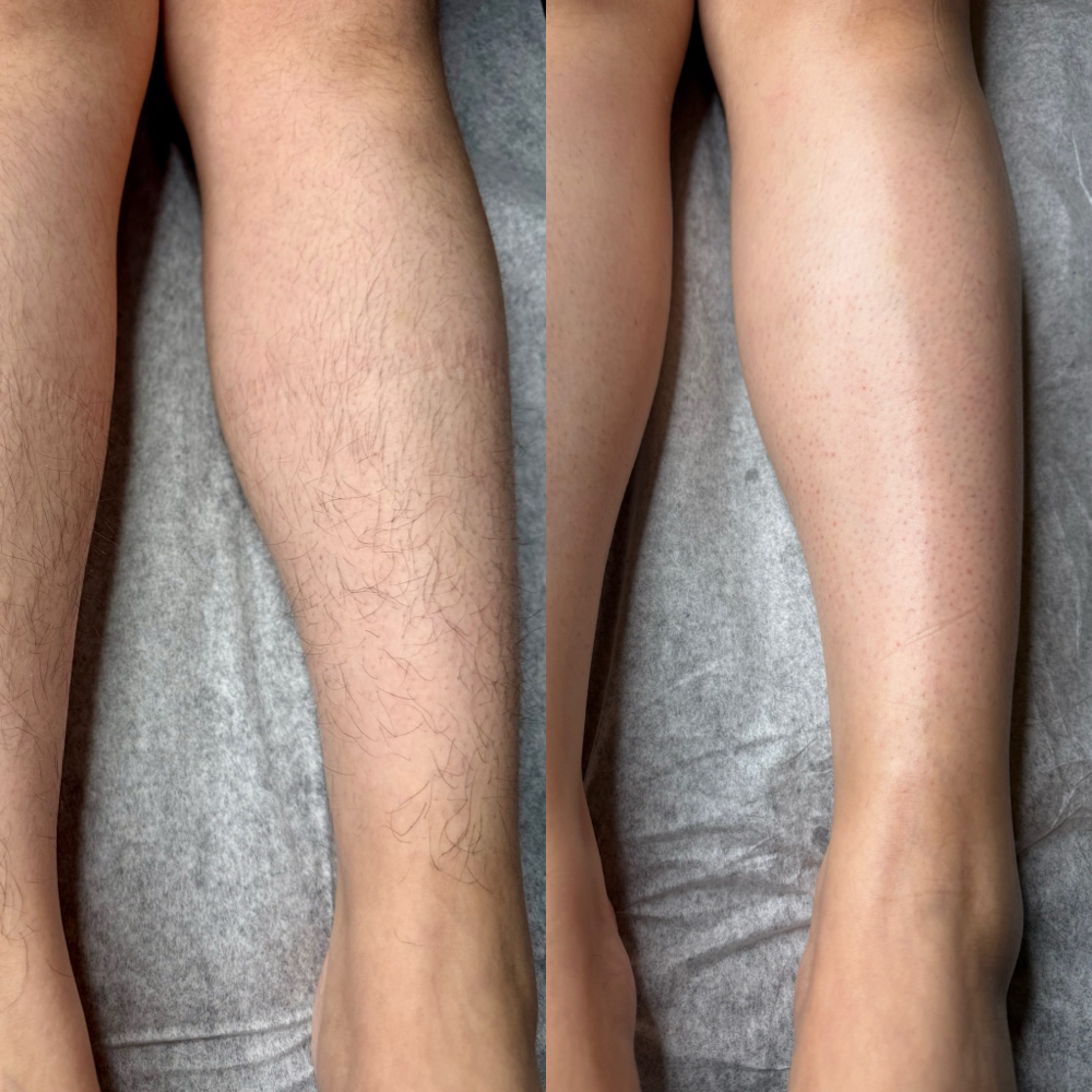 Full Legs Sugar Waxing at Vixen Brows & Sugar Waxing in Corona, CA