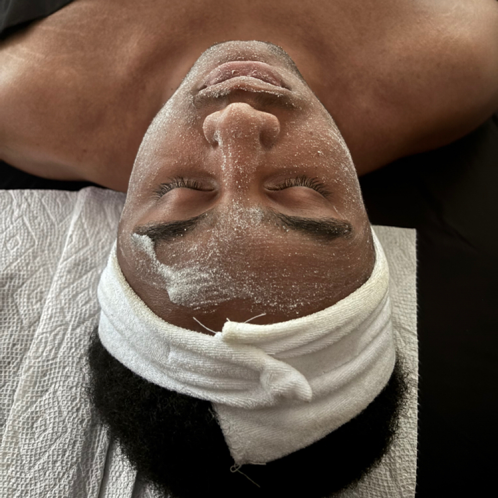 The Acne Renewal at Jai Skin Studios