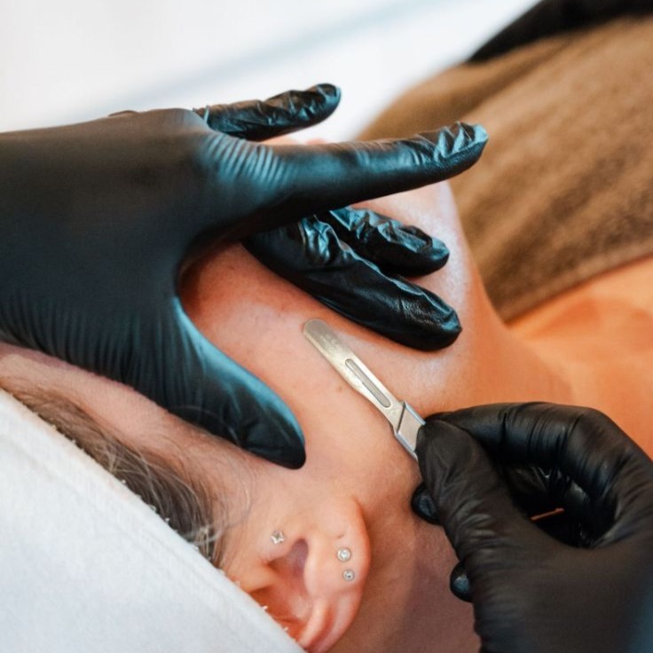 Dermaplaning at Luminous Skin Care & Brow Studio in Sugar Land, TX