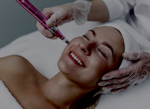 Micro Needling facial