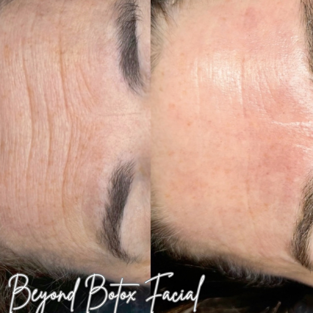 Beyond Botox Facial at Blessed Beauty Aesthetics, LLC in Houston, TX