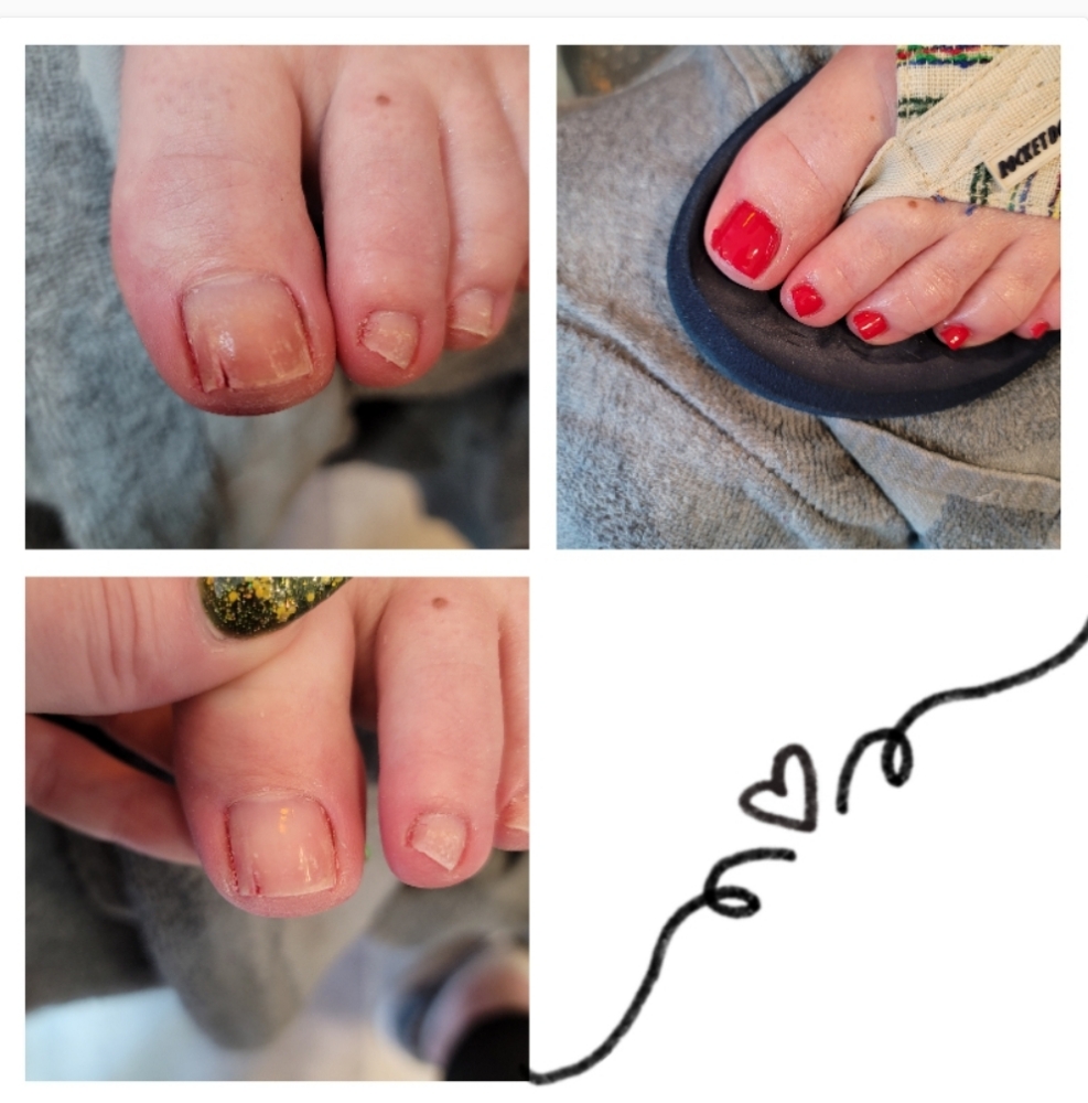 Natural/Enhanced Nail Repairs