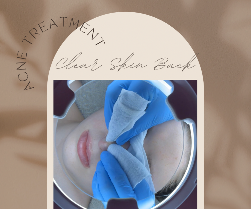 Clear Skin Back Facial