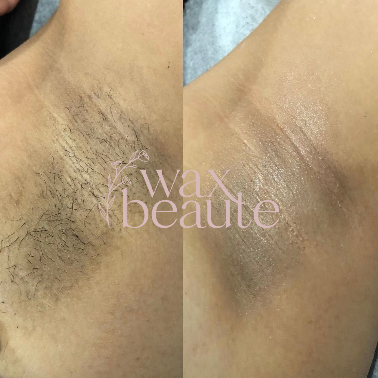 Underarm Wax