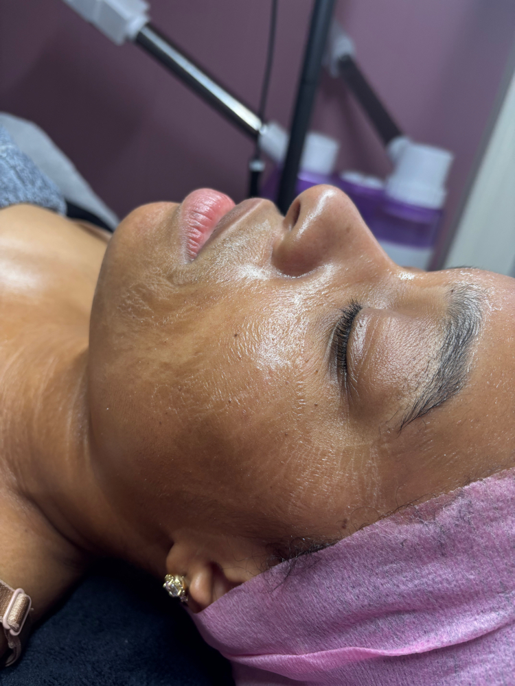 Wrinkles Be Gone!