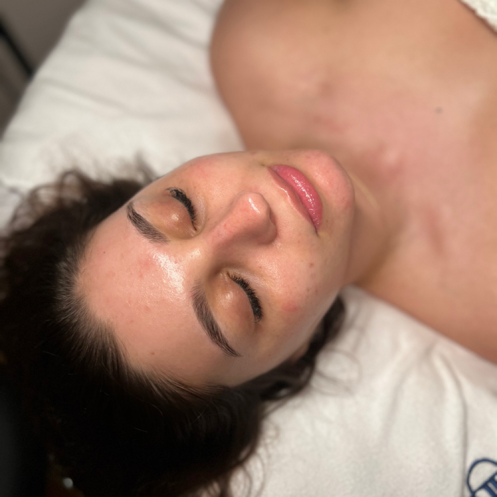 Express Facial at AM Aesthetics in Astoria, NY