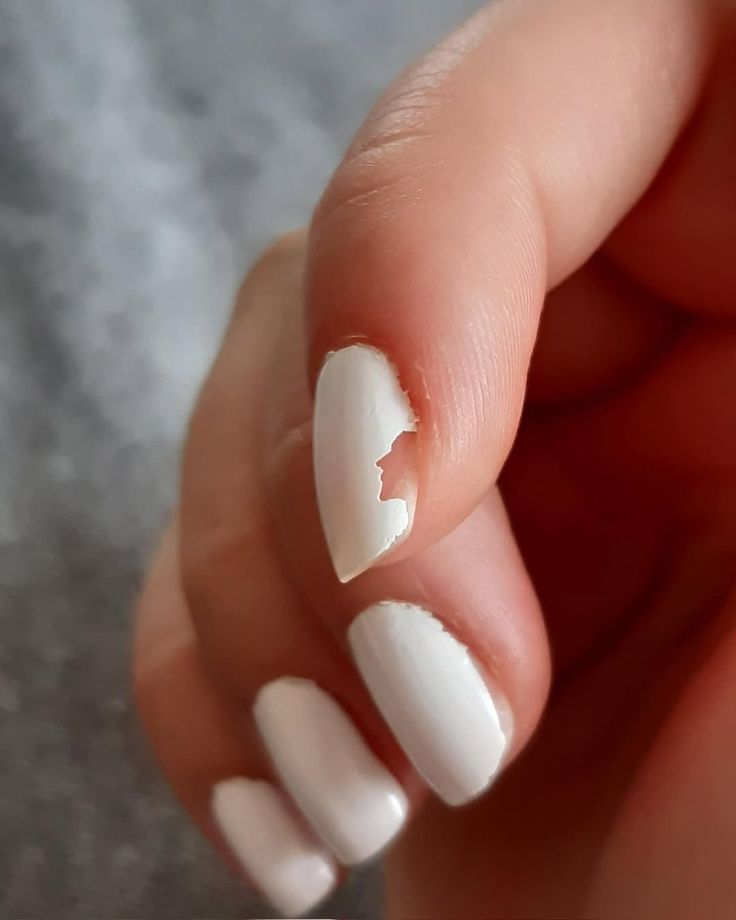 Broken nail Repair at KOVA in aurora, CO