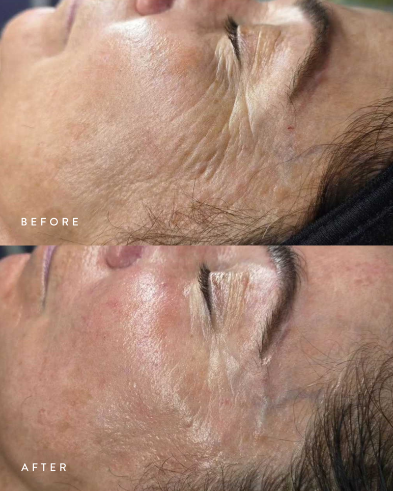 Berry Bright + Balanced Facial