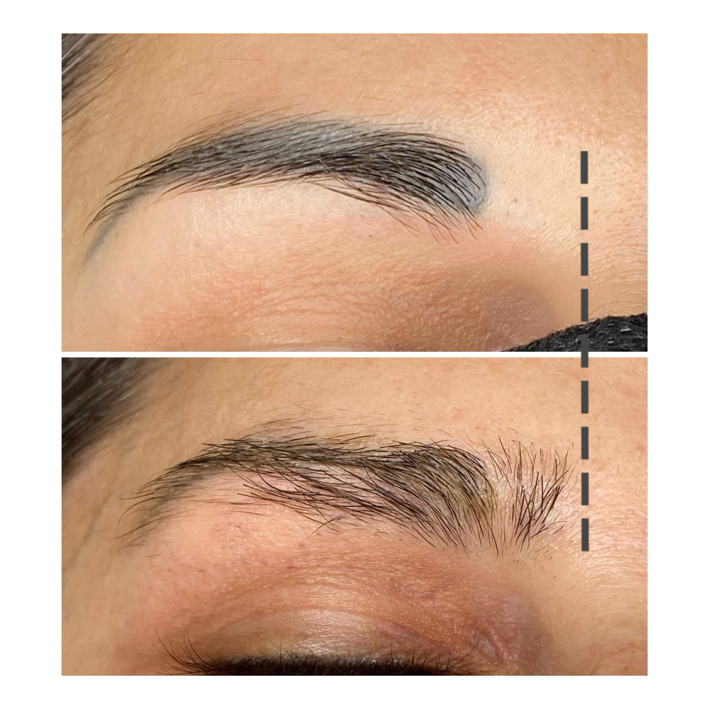 Eyebrow Rejuvination