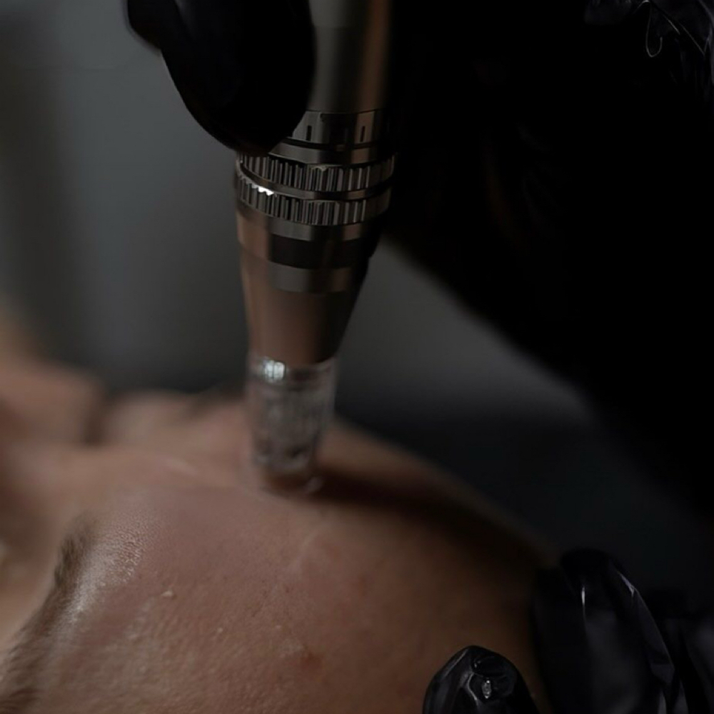 Meso Therapy Repairing Facial at Skintuition Skincare Boutique in Pewee Valley, KY