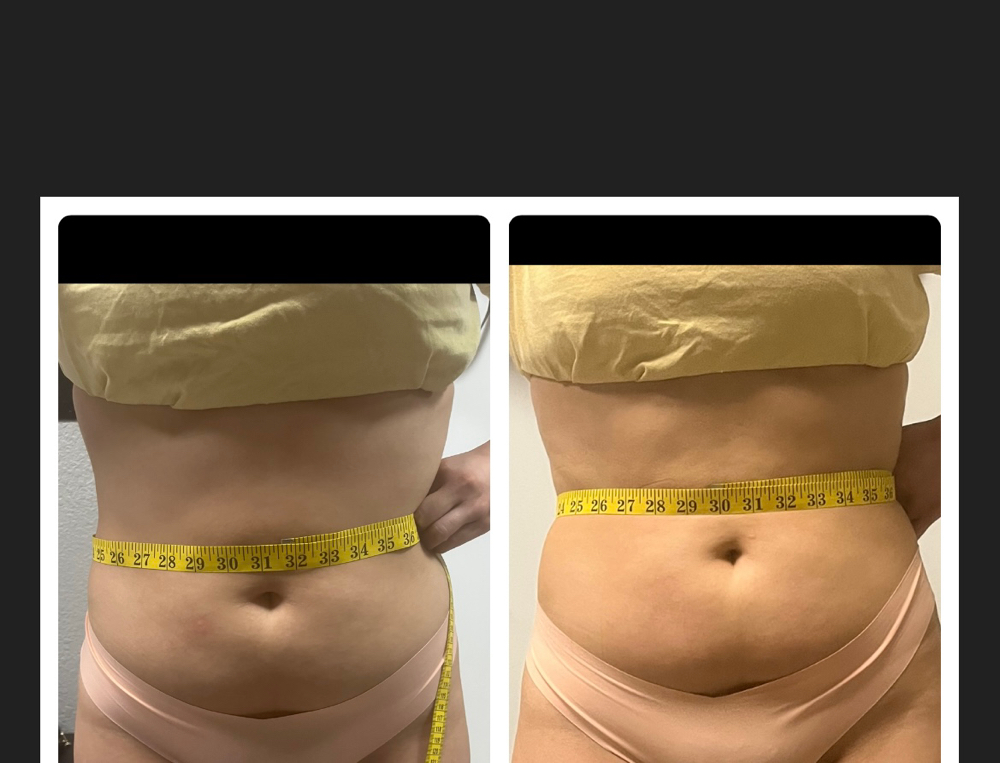 Summer Body Glam Special