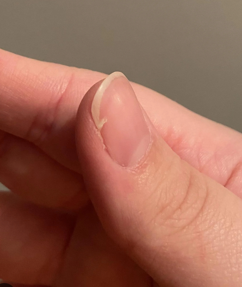 Nail Repair-Per nail at Set-Apart Nails By Jo in San Angelo, TX