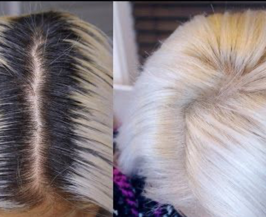 Bleach Retouch