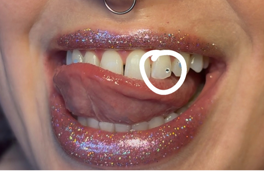 1 Round Gem Application