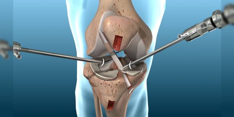 Knee Surgery Relief
